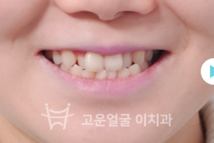 치료사례